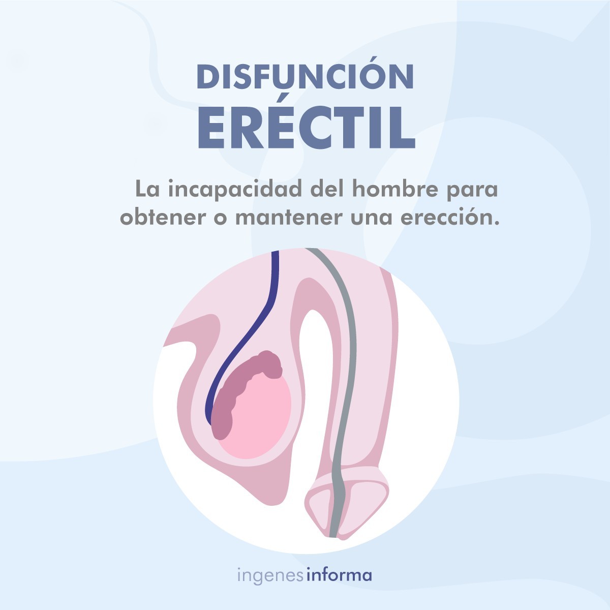 infertilidad masculina Inforgrafias_DisfunErectil