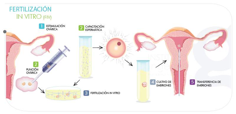 gráfica FIV transferencia embrionaria