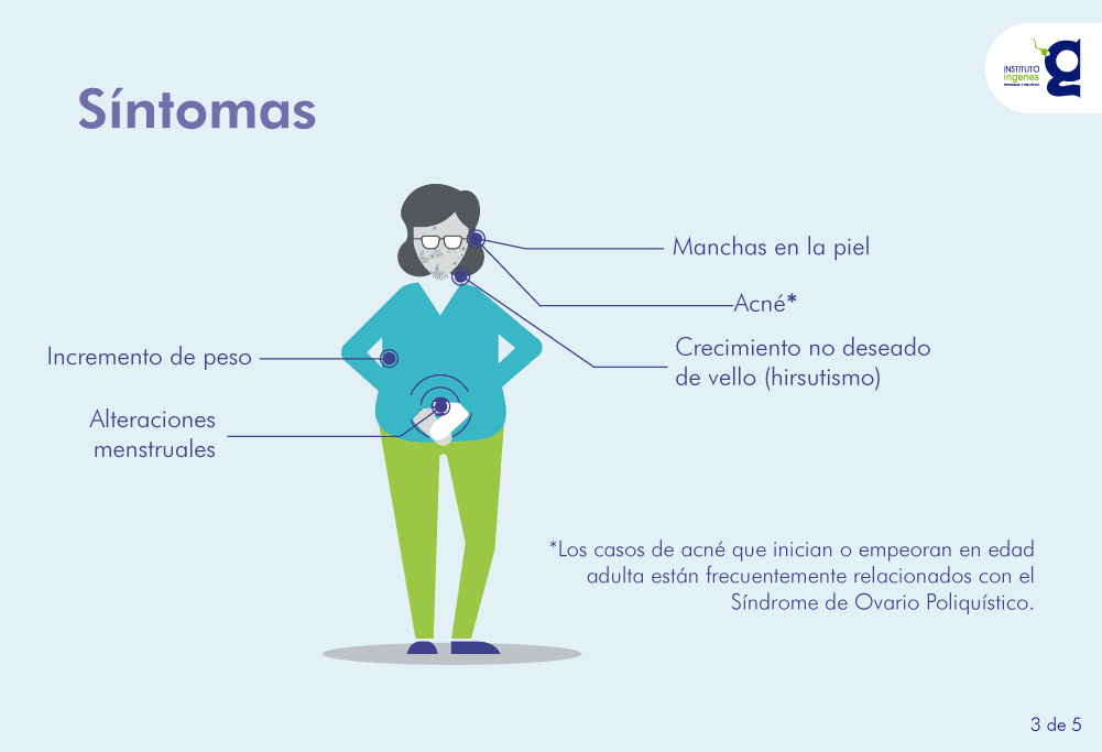 Diapositiva sobre SOP