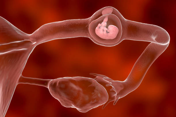 embarazo-ectopico-animacion-de-embrion-en-trompas