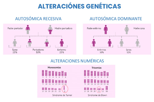 turner-syndrome-what-is-it-and-how-to-detect-it