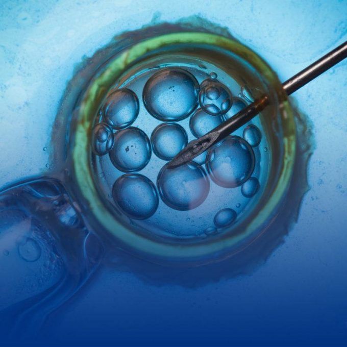 clamidia-clinicas-de-infertilidad-ingenes-reproduccion-asistida-canula-extrayendo-ovulos-puncion-ovarica-como-parte-de-un-tratamiento-de-fecundacion-in-vitro