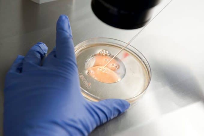 the-secret-for-a-successful-in-vitro-fertilization-fertilization-of-ovules-in-petri-dish-close-up-in-ingenes-ivf-laboratory