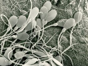 biopsia-testicular-para-detectar-el-origen-de-la-infertilidad-masculina-vista-microscopica-de-espermatozoides