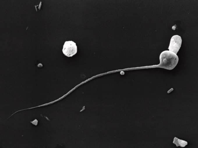 biopsia-testicular-para-detectar-el-origen-de-la-infertilidad-masculina-vista-microscopica-de-espermatozoide-con-alteracion