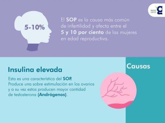 sindrome-de-ovario-poliquistico-segun-la-edad-de-la-mujer-sop-causa-mas-comun-de-infertilidad-en-las-mujeres