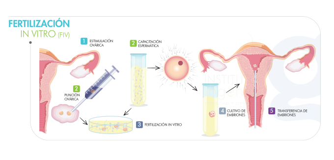 sindrome-de-ovario-poliquistico-segun-la-edad-de-la-mujer-procedimiento-para-realizar-fecundacion-in-vitro