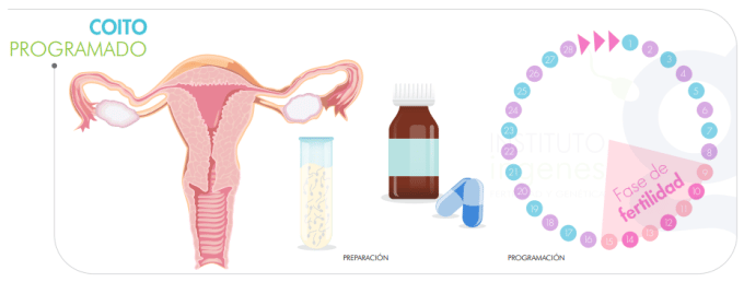 sindrome-de-ovario-poliquistico-segun-la-edad-de-la-mujer-procedimiento-para-realizar-coitos-programados