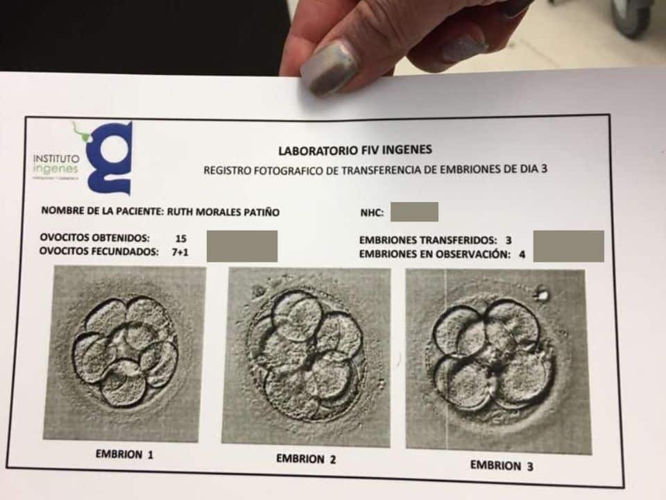 mama-a-los-40-hoja-de-laboratorio-ingenes-con-imagen-de-embriones-y-sus-celulas-divididas-vista-de-microscopio