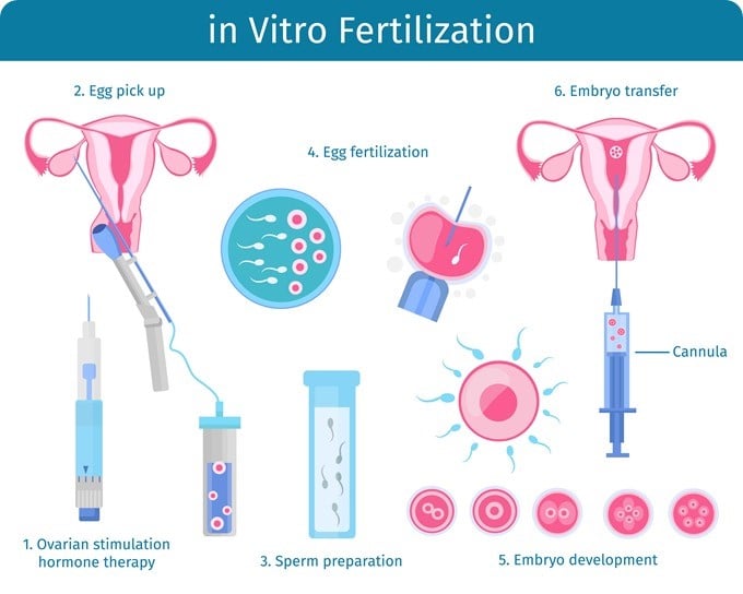 in-vitro-fertilization-treatment-beyond-infertility-ivf-procedure