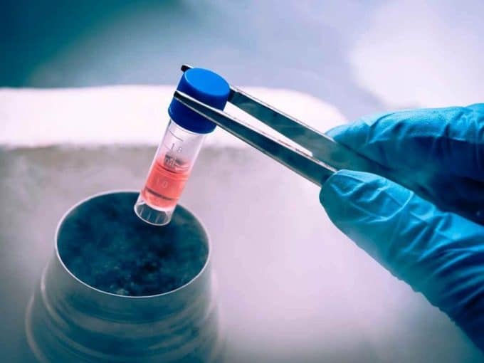 image-in-laboratory-in-vitro-freezing-embryos