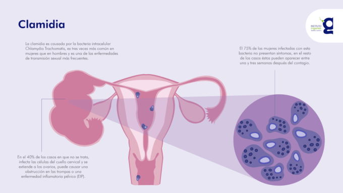 clamidia-positiva-que-hacer-infografia