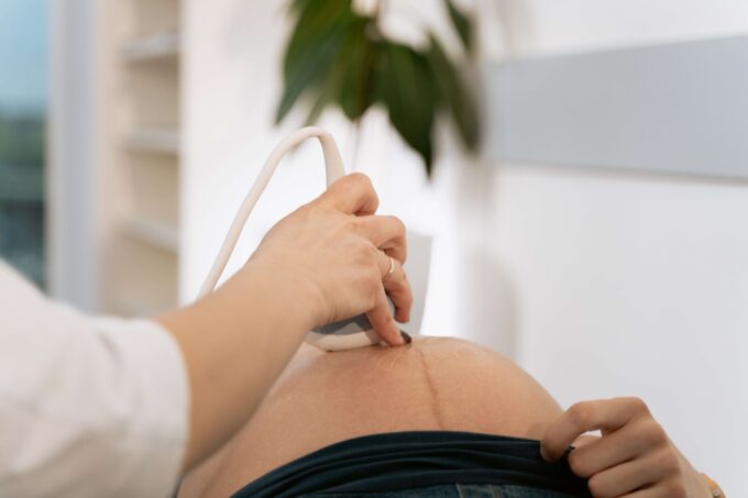 ultrasonido-mujer-embarazada