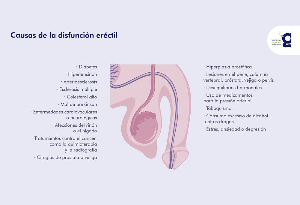 próstata y disfunción eréctil)