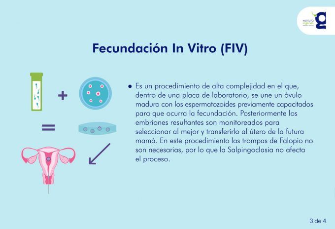 ligadura-de-trompas-salpingo-embarazo-in-vitro